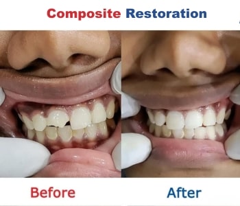 Before After 2